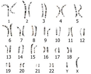 23 pairs of chromosomes stained to show light and dark bands