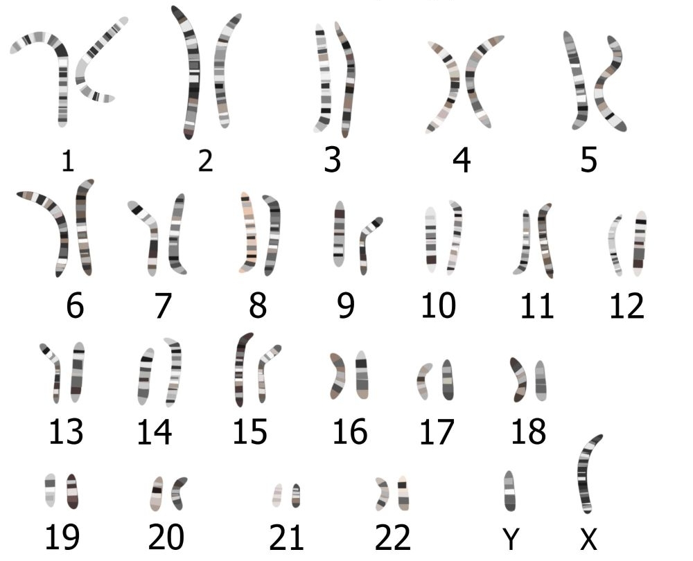 23 pairs of chromosomes stained to show light and dark bands